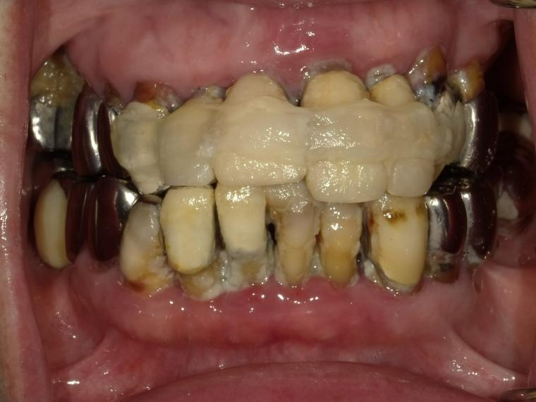 BEFORE